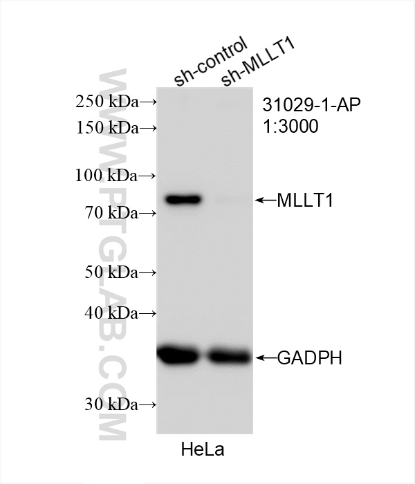 WB analysis of HeLa using 31029-1-AP (same clone as 31029-1-PBS)