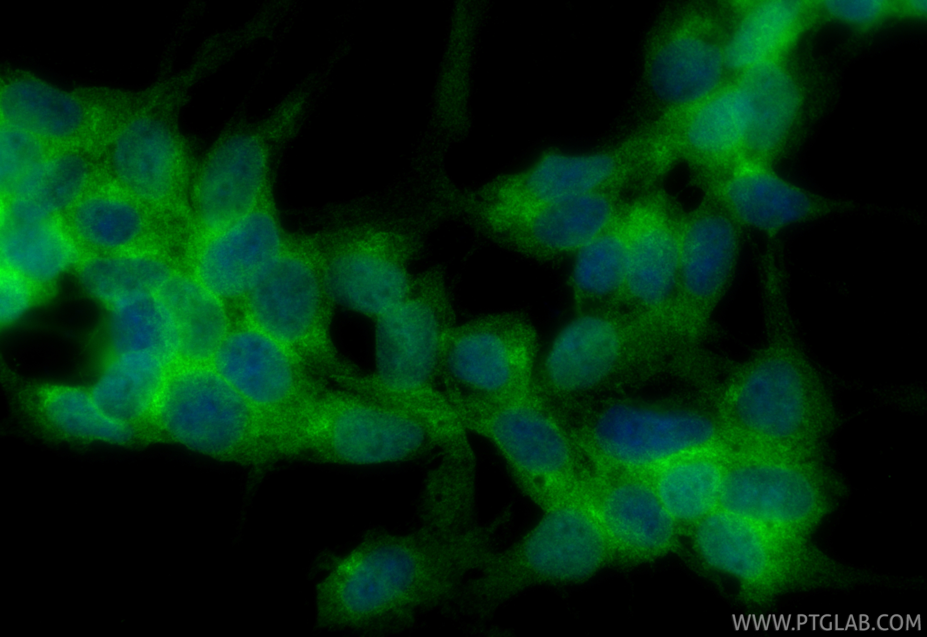 IF Staining of SH-SY5Y using 12062-1-AP (same clone as 12062-1-PBS)