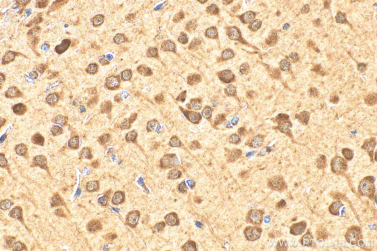 IHC staining of mouse brain using 12062-1-AP
