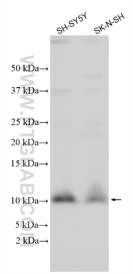 WB analysis using 12062-1-AP