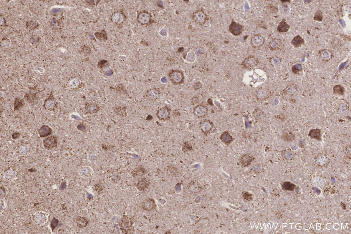 IHC staining of mouse brain using 20292-1-AP IHC staining of mouse brain using 20292-1-AP