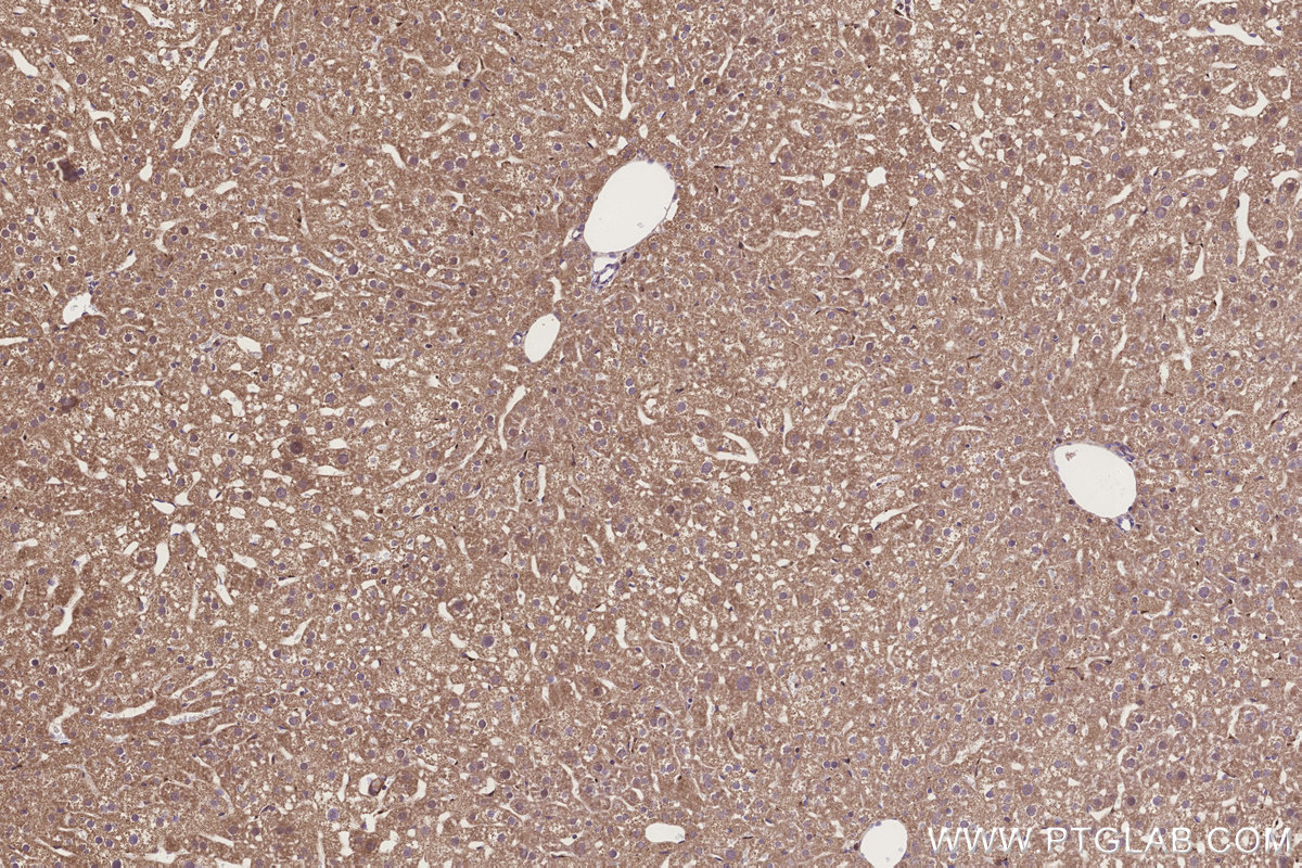 IHC staining of mouse liver using 20292-1-AP IHC staining of mouse liver using 20292-1-AP
