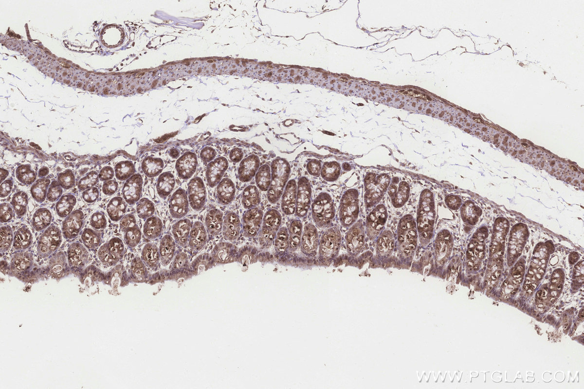 IHC staining of rat colon using 20292-1-AP IHC staining of rat colon using 20292-1-AP