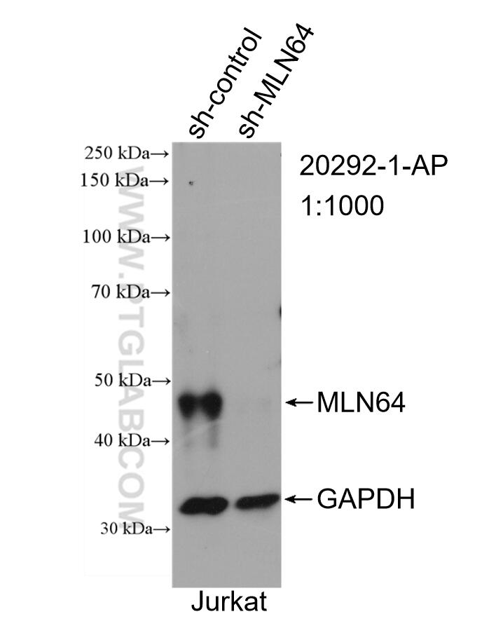 WB analysis of Jurkat using 20292-1-AP