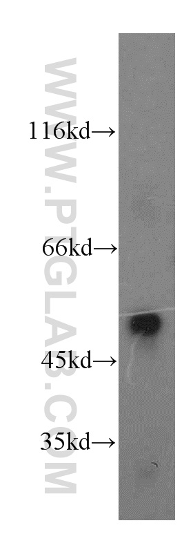 WB analysis of MCF-7 using 20292-1-AP