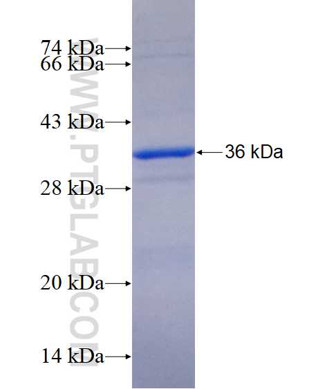 MLN64,STARD3 fusion protein Ag14282 SDS-PAGE