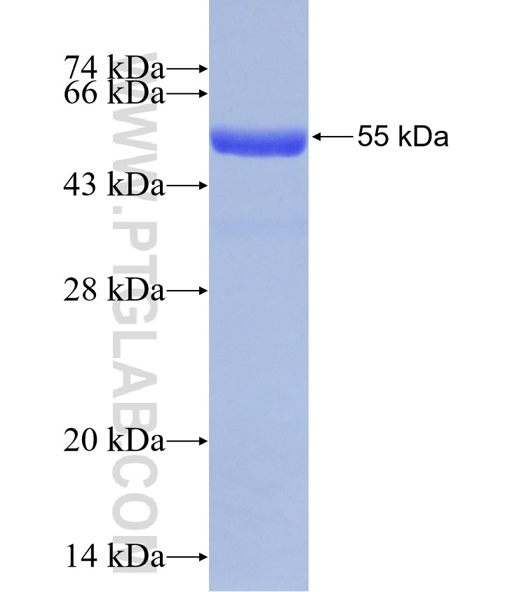 MLN64,STARD3 fusion protein Ag31477 SDS-PAGE