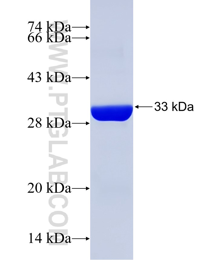 MLN64,STARD3 fusion protein Ag31491 SDS-PAGE MLN64,STARD3 fusion protein Ag31491 SDS-PAGE