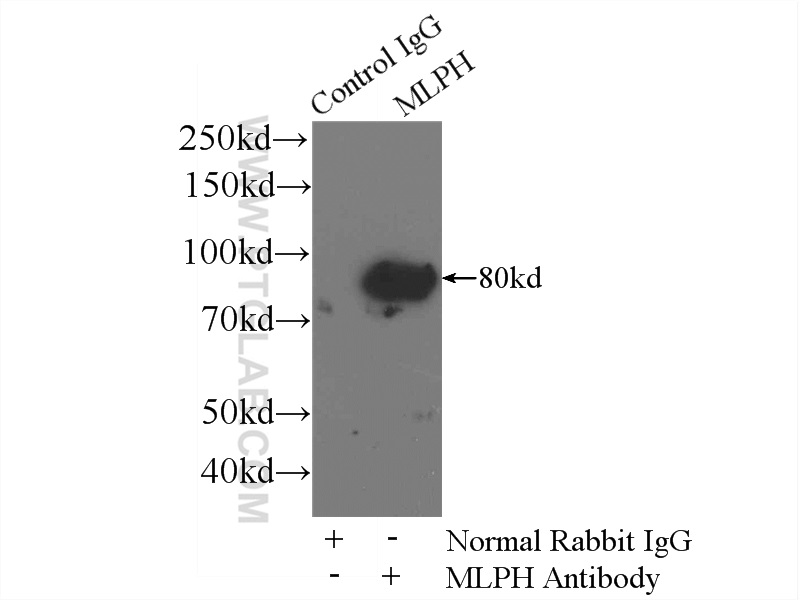 IP experiment of A375 using 10338-1-AP