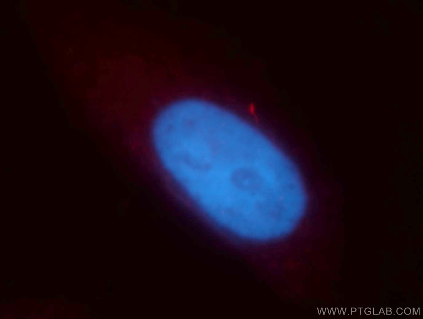 IF Staining of HepG2 using 13614-1-AP