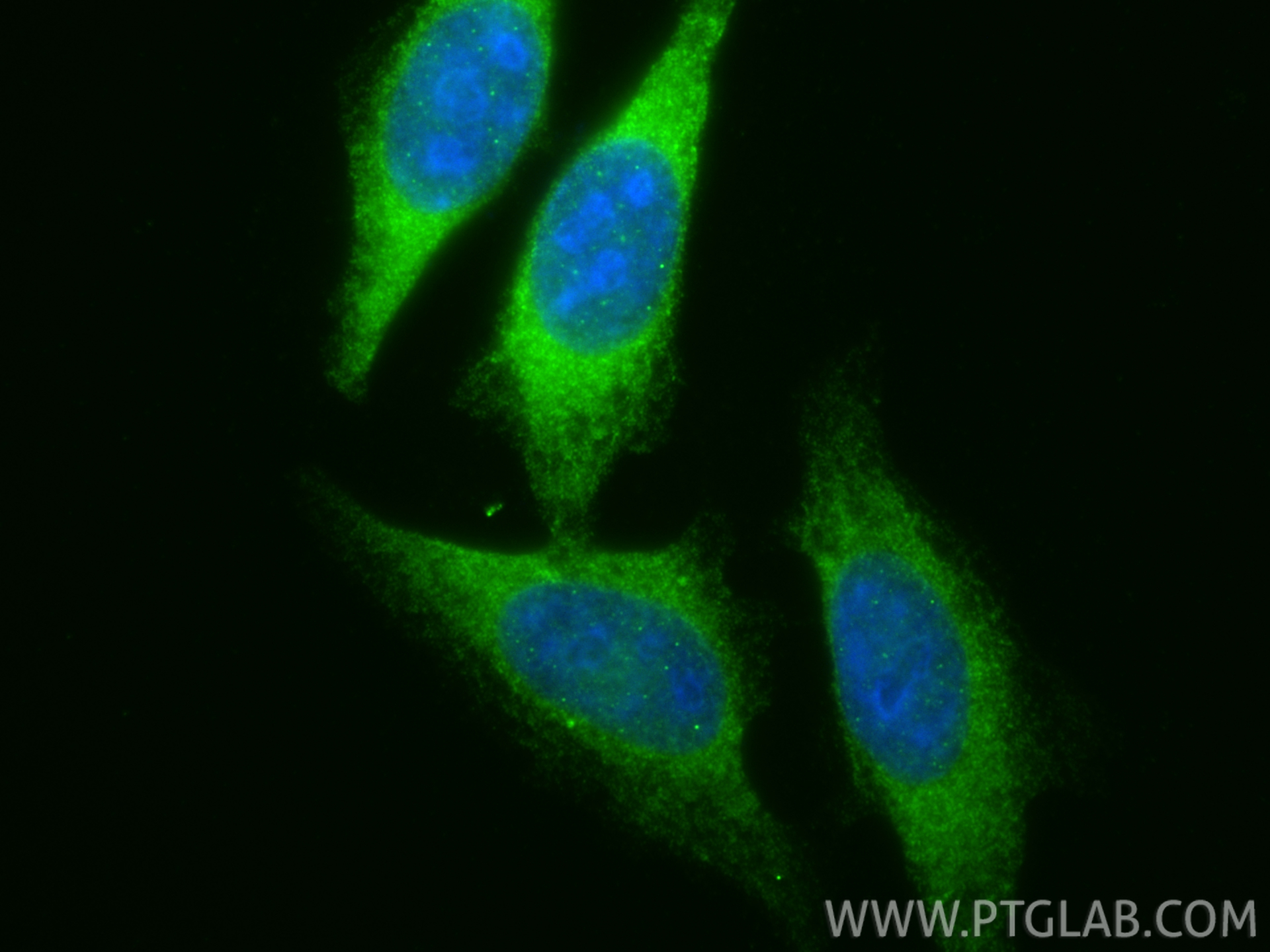 IF Staining of HepG2 using 13256-1-AP IF Staining of HepG2 using 13256-1-AP