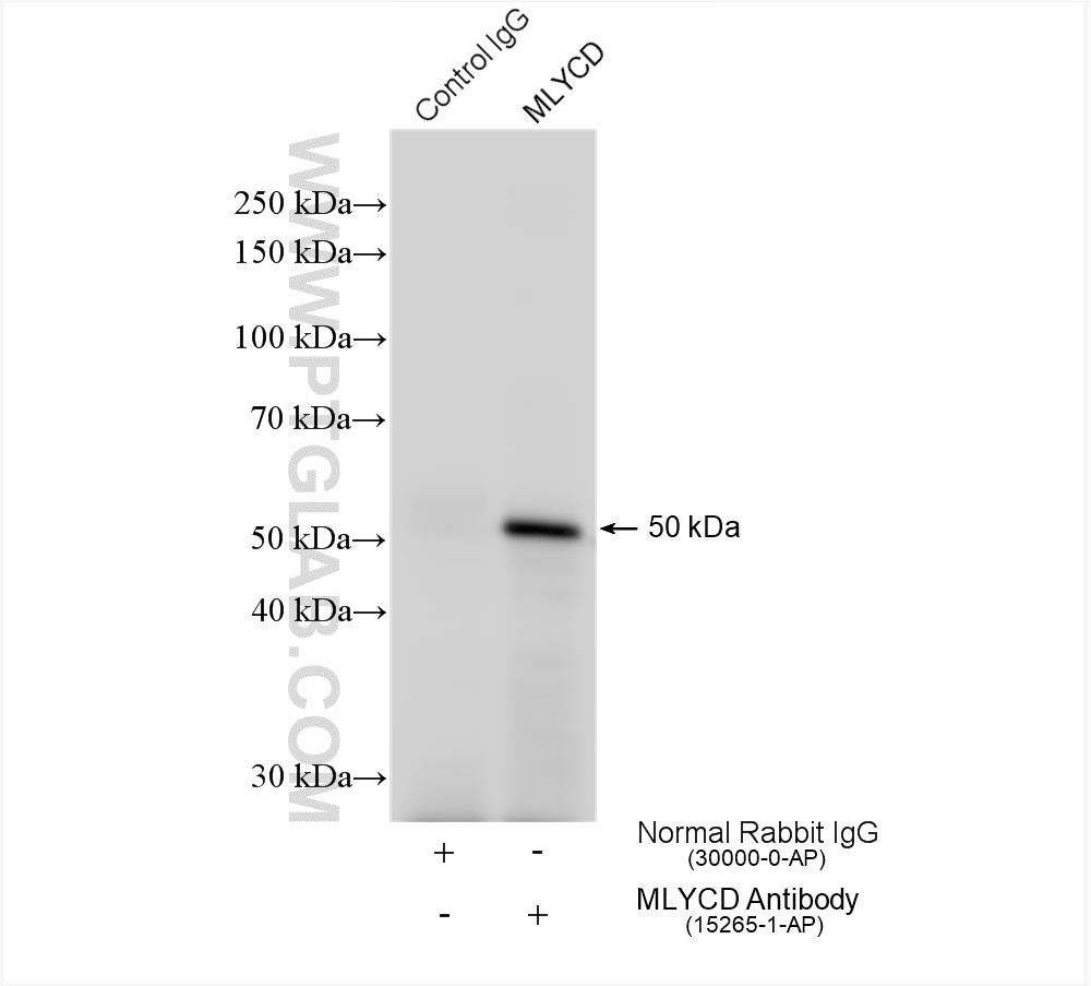 IP experiment of mouse liver using 15265-1-AP