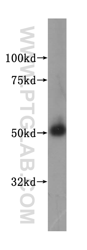 WB analysis of human testis using 15265-1-AP