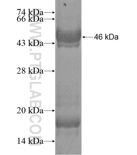 MMAA fusion protein Ag20370 SDS-PAGE MMAA fusion protein Ag20370 SDS-PAGE