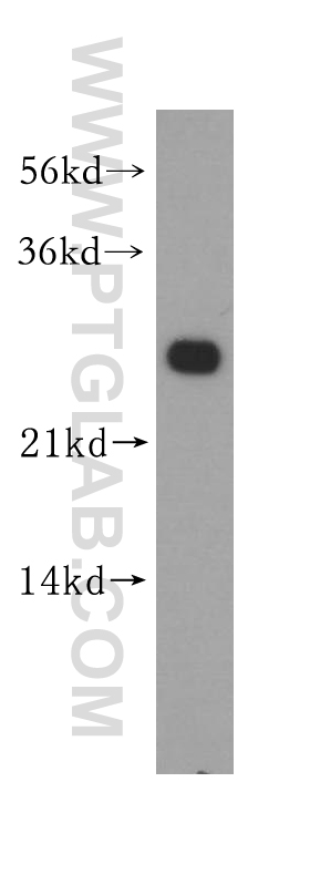 WB analysis of HeLa using 11137-1-AP