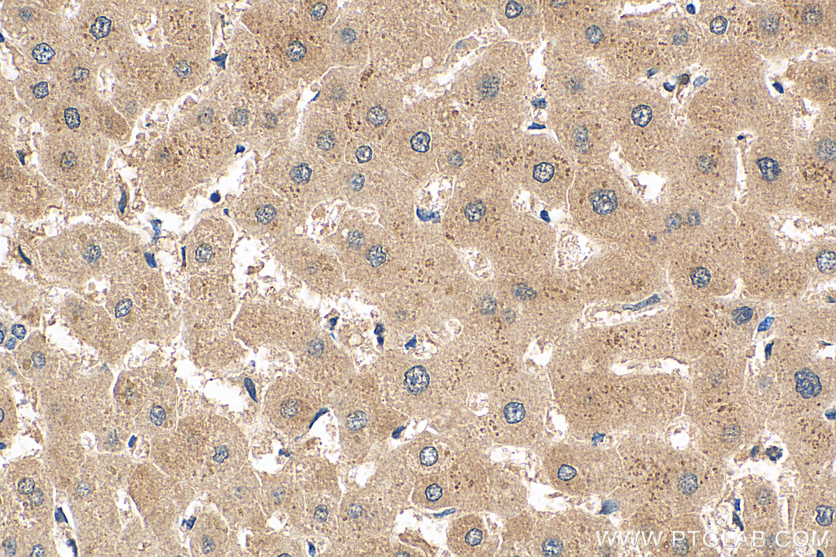 IHC staining of human liver using 21462-1-AP