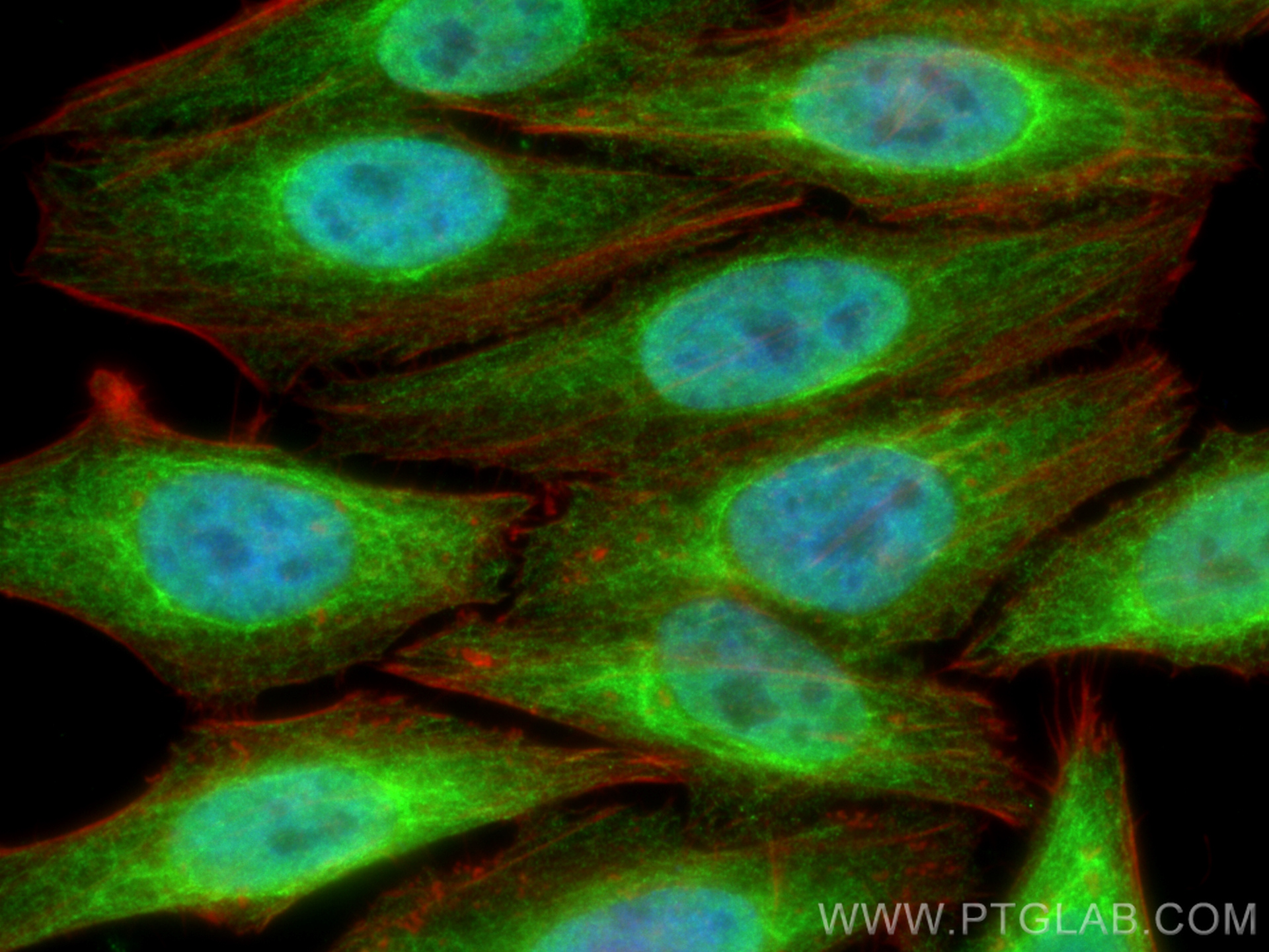 IF Staining of HepG2 using 66609-1-Ig