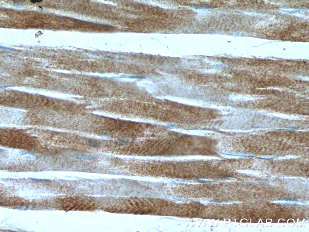 IHC staining of human skeletal muscle using 23191-1-AP