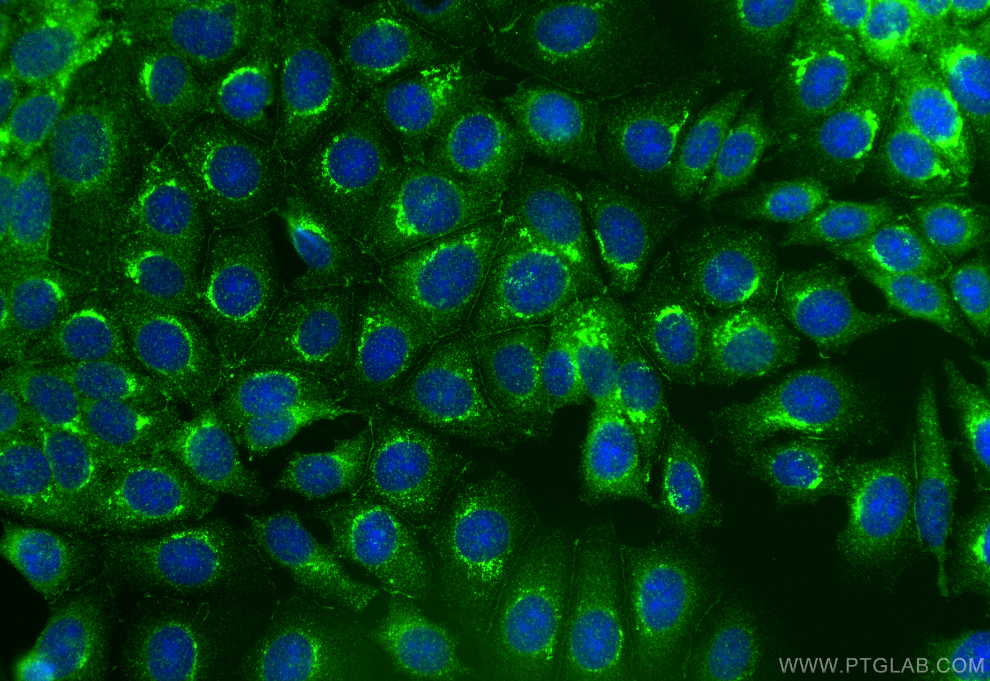IF Staining of MCF-7 using 10302-1-AP