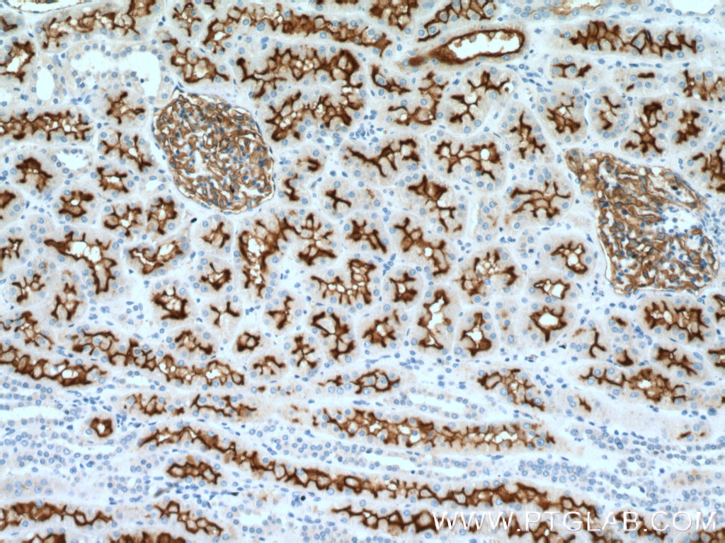 IHC staining of human kidney using 10302-1-AP