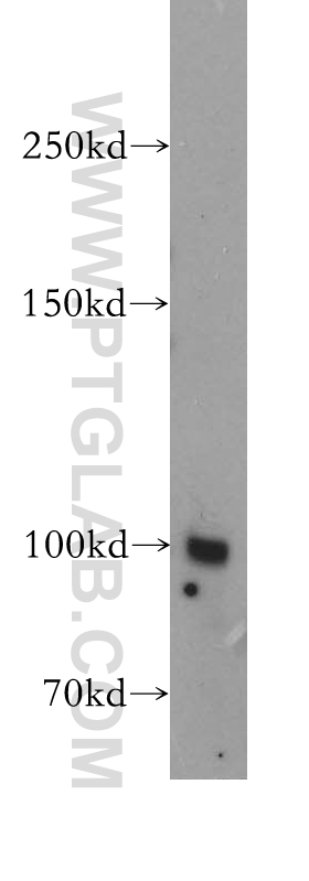 MME,CD10 Polyclonal antibody