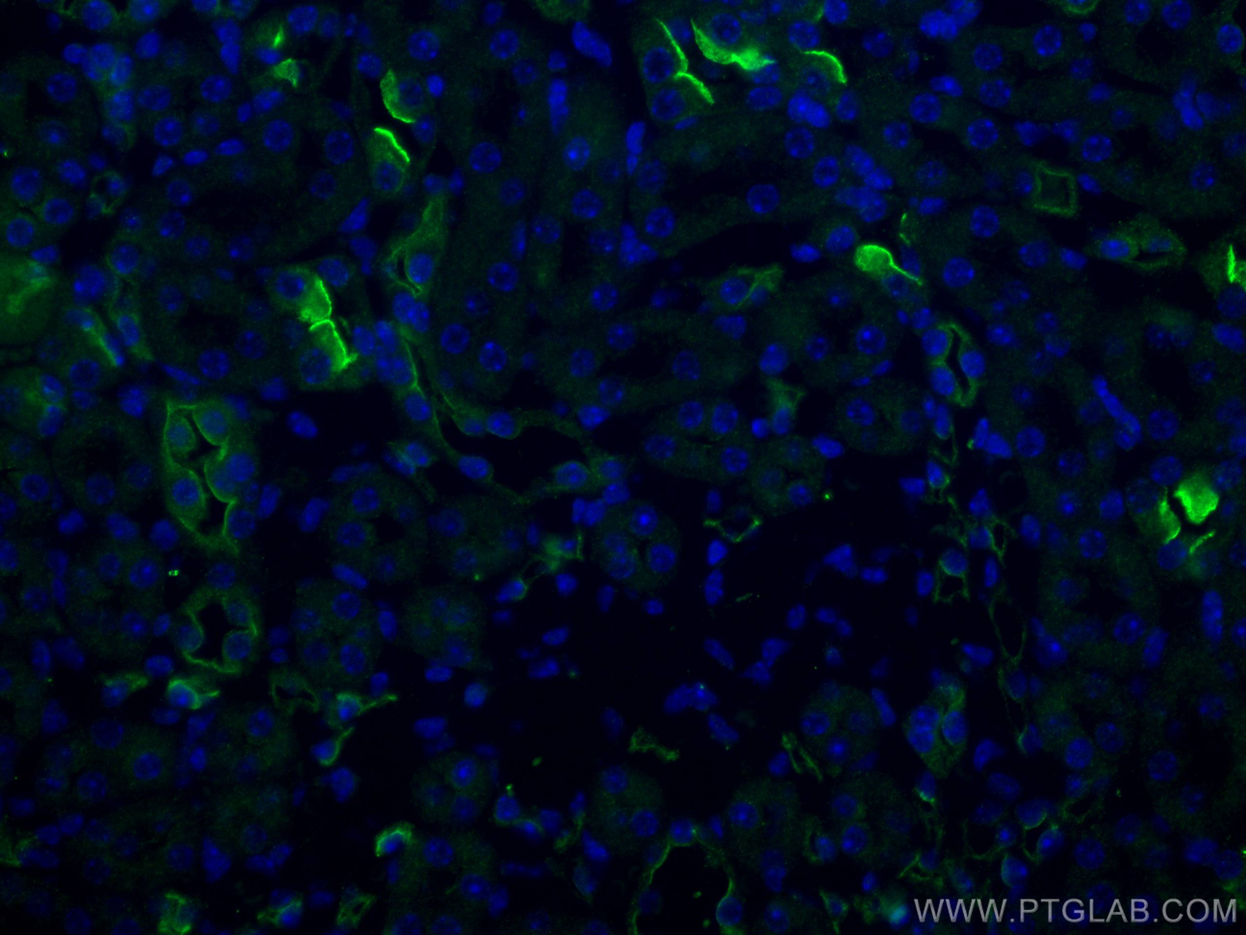 IF Staining of mouse kidney using 23898-1-AP