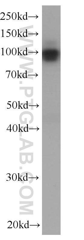 WB analysis of pig kidney using 60034-3-Ig (same clone as 60034-3-PBS)