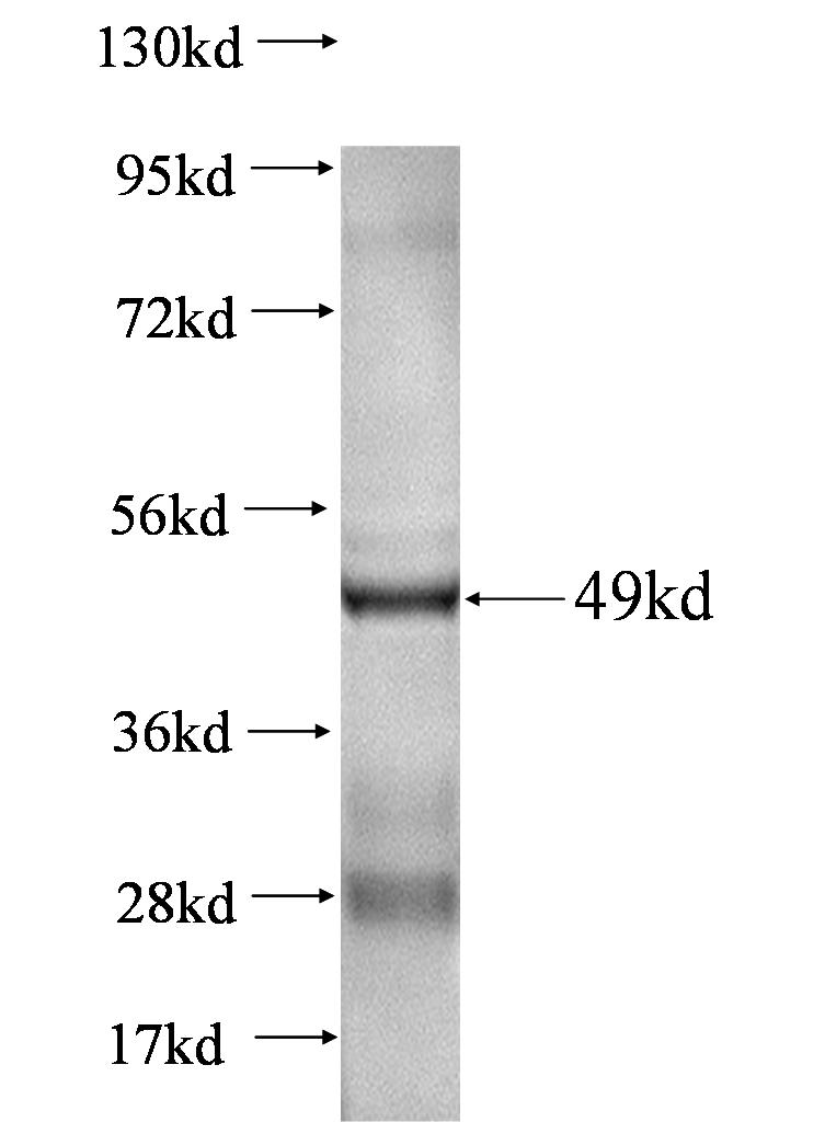 MME,CD10 fusion protein Ag0427 SDS-PAGE