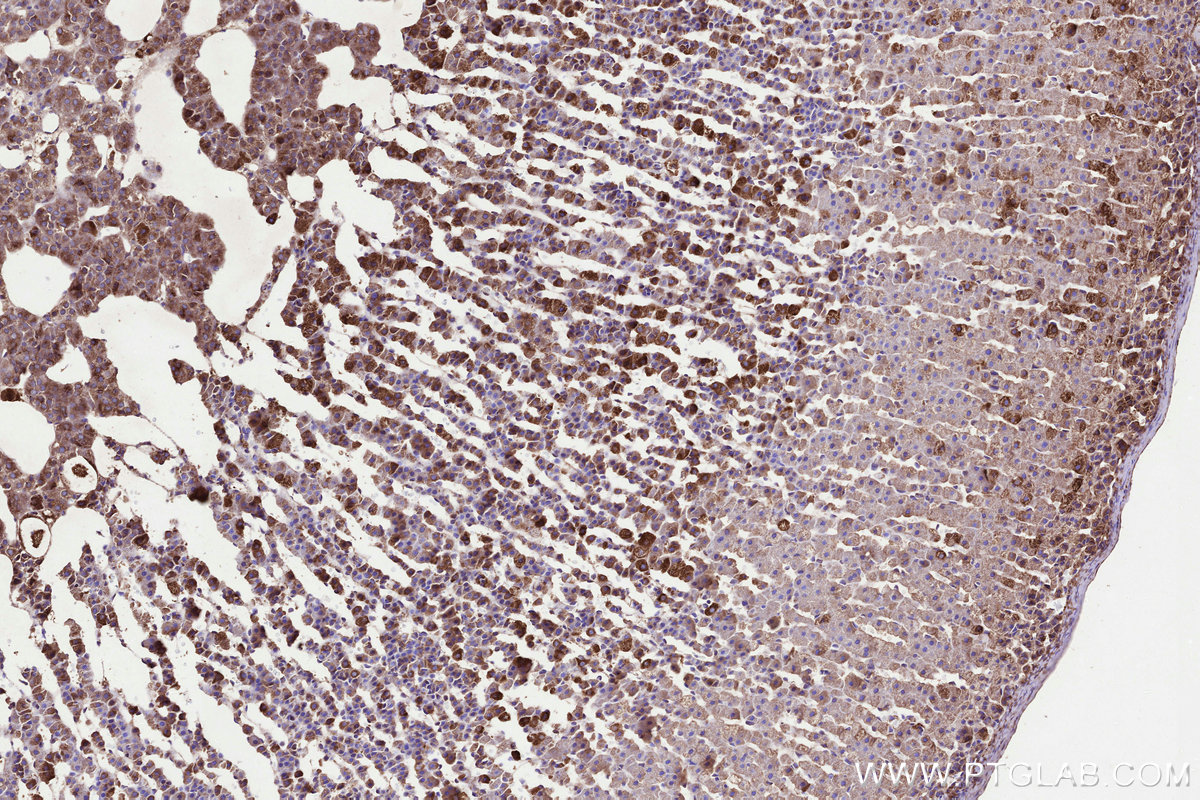 IHC staining of rat adrenal gland using 31166-1-AP