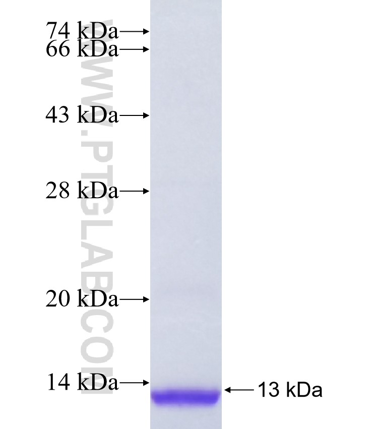 MMGT1 fusion protein Ag35580 SDS-PAGE