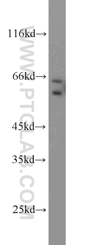 MMP1 Polyclonal antibody