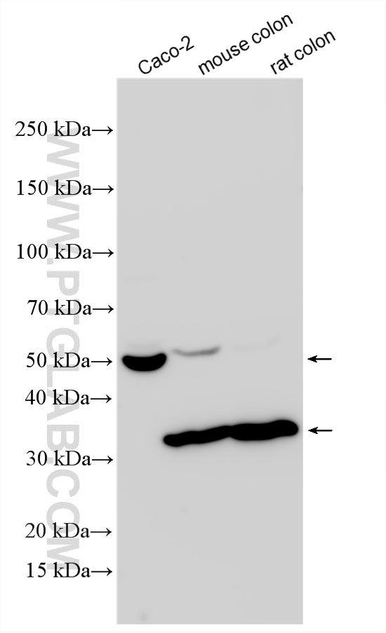 Various lysates were subjected to SDS PAGE followed by western blot with 30805-1-AP (MMP1 antibody) at dilution of 1:2000 incubated at room temperature for 1.5 hours. WB analysis using 30805-1-AP