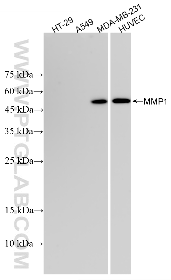 WB analysis using 83114-6-RR WB analysis using 83114-6-RR