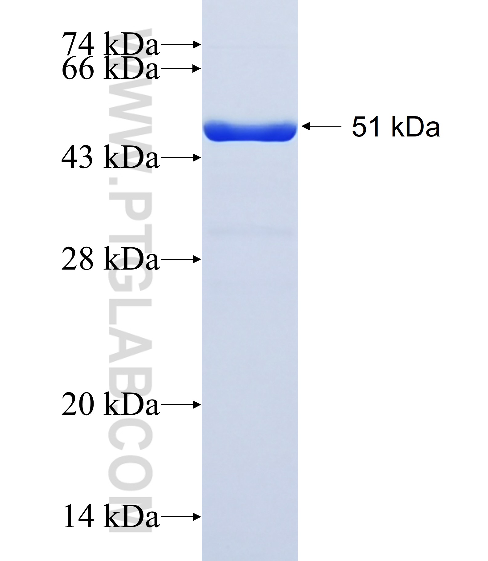 MMP10 fusion protein Ag41746 SDS-PAGE MMP10 fusion protein Ag41746 SDS-PAGE