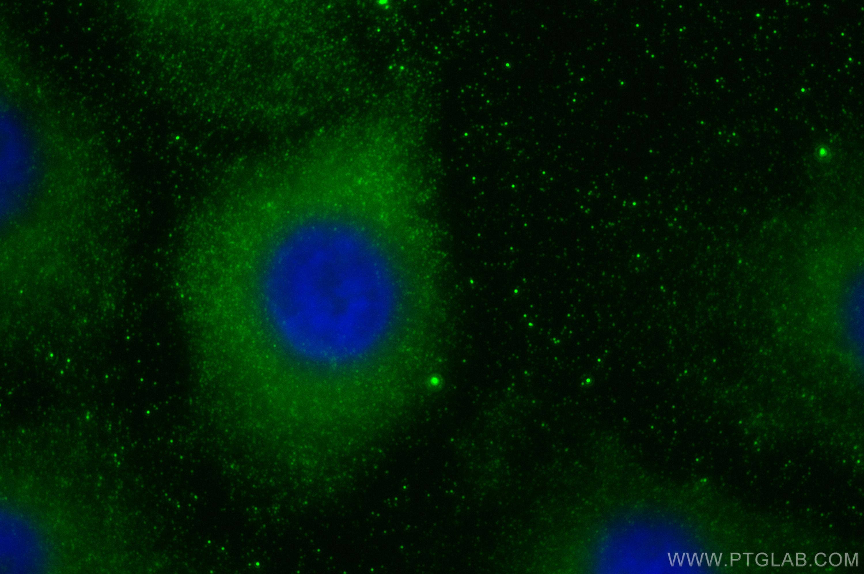 IF Staining of A549 using 30615-1-AP