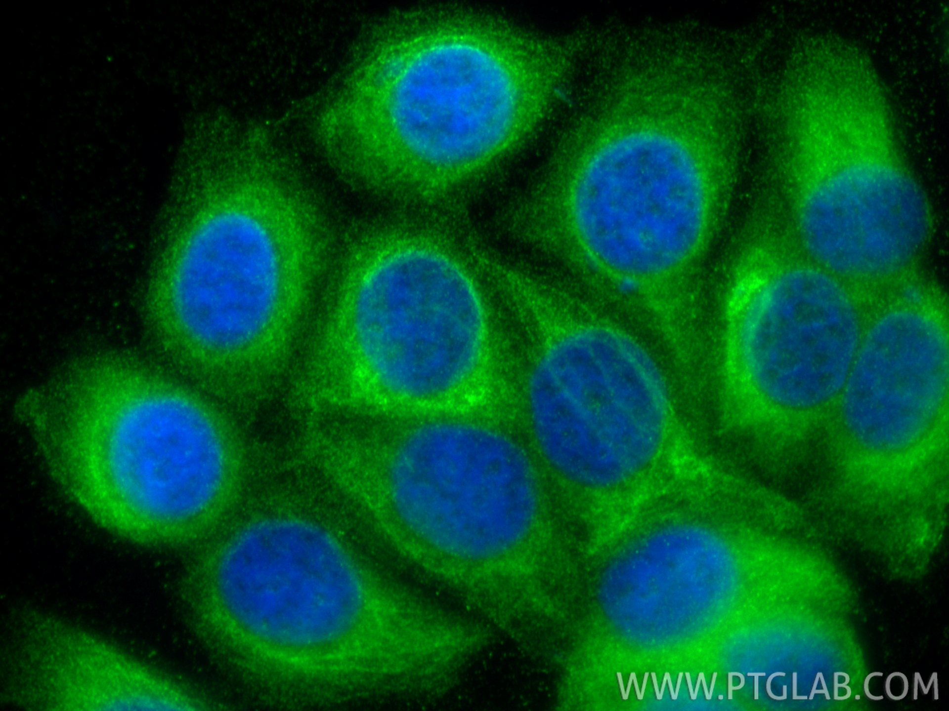 Immunofluorescent analysis of (-20°C Methanol) fixed MCF-7 cells using MMP11 antibody (30615-1-AP) at dilution of 1:400 and CoraLite®488-Conjugated Goat Anti-Rabbit IgG(H+L) (<a class='green' href='/productredirect?CatalogNo=SA00013-2' target='_blank'>SA00013-2</a>). IF Staining of MCF-7 using 30615-1-AP