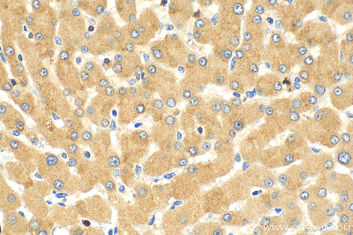 IHC staining of human liver using 18165-1-AP