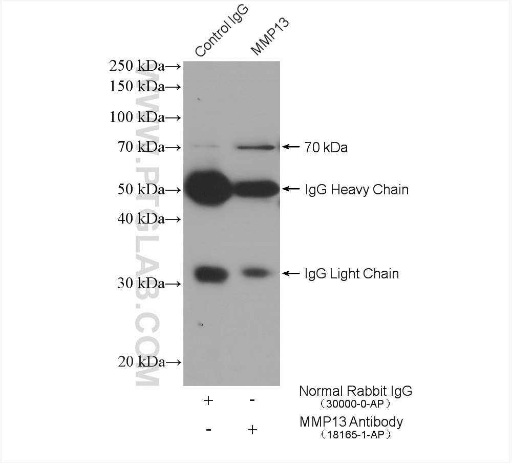 IP experiment of MCF-7 using 18165-1-AP