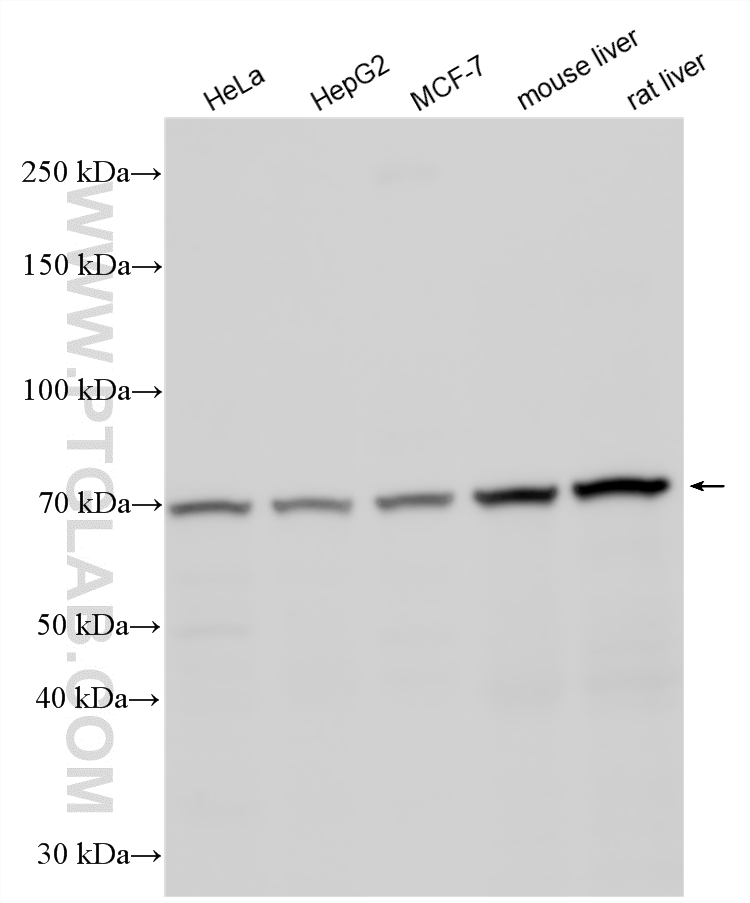 Various lysates were subjected to SDS PAGE followed by western blot with 18165-1-AP (MMP13 antibody) at dilution of 1:2000 incubated at room temperature for 1.5 hours. WB analysis using 18165-1-AP