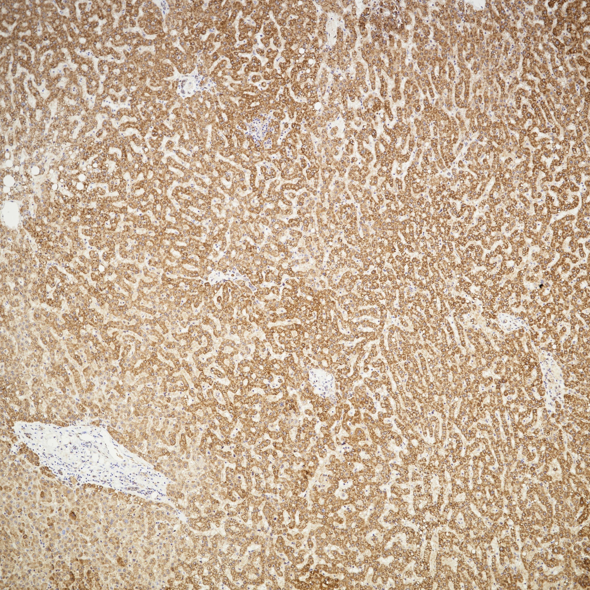 IHC staining of human liver using 83188-4-RR