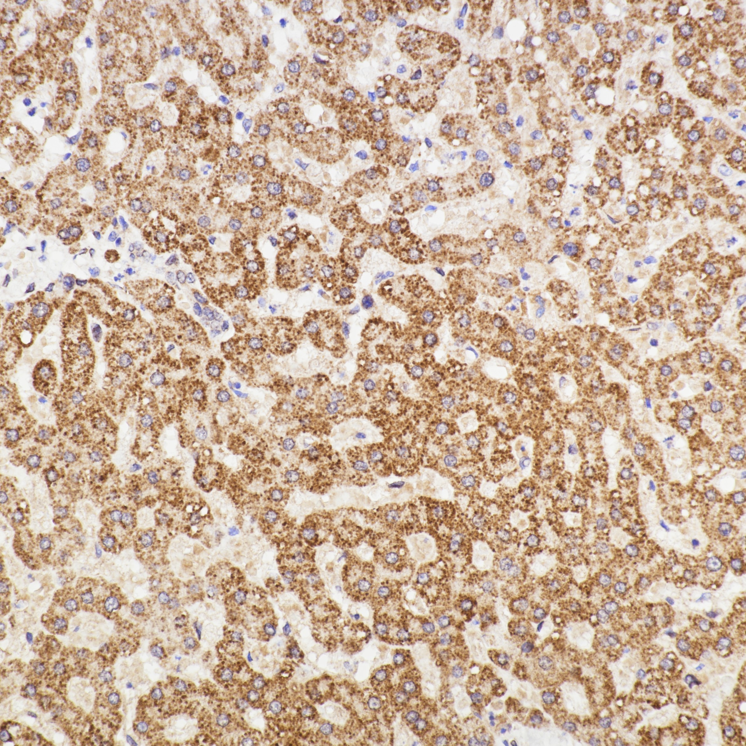 IHC staining of human liver using 83188-4-RR