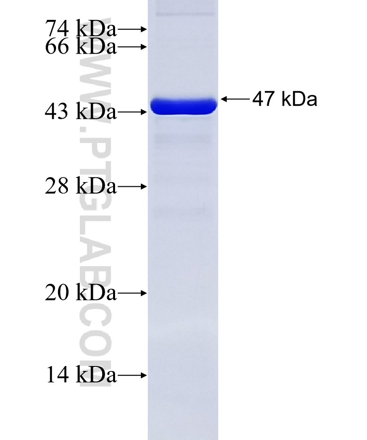 MMP16 fusion protein Ag12719 SDS-PAGE MMP16 fusion protein Ag12719 SDS-PAGE