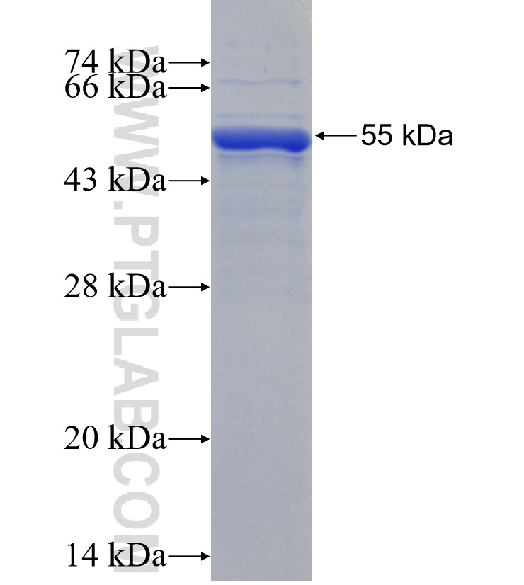 MMP17 fusion protein Ag29298 SDS-PAGE