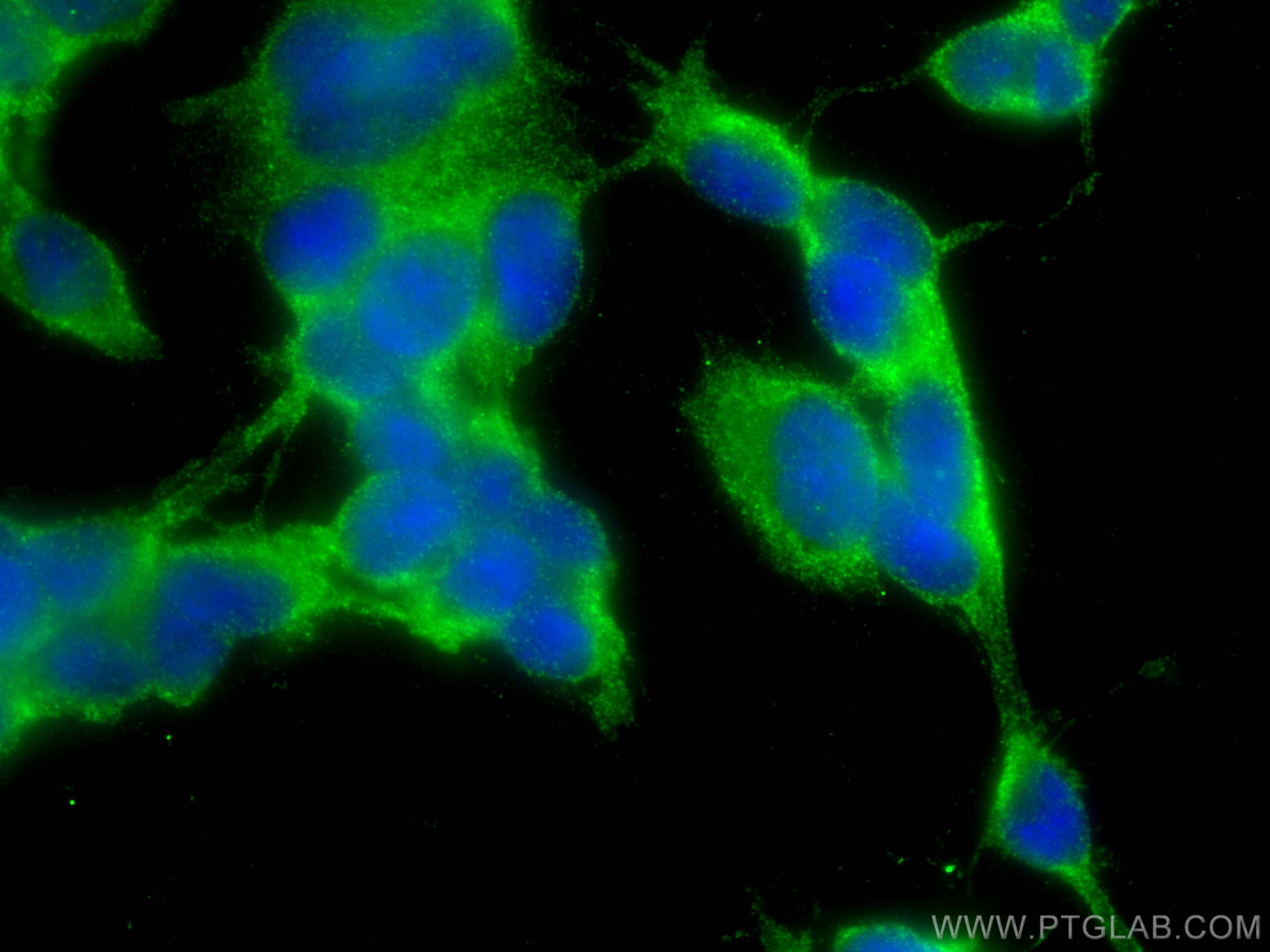 IF Staining of SH-SY5Y using 14244-1-AP