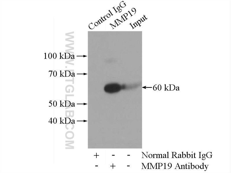 IP experiment of human placenta using 14244-1-AP
