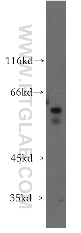 WB analysis of SH-SY5Y using 14244-1-AP