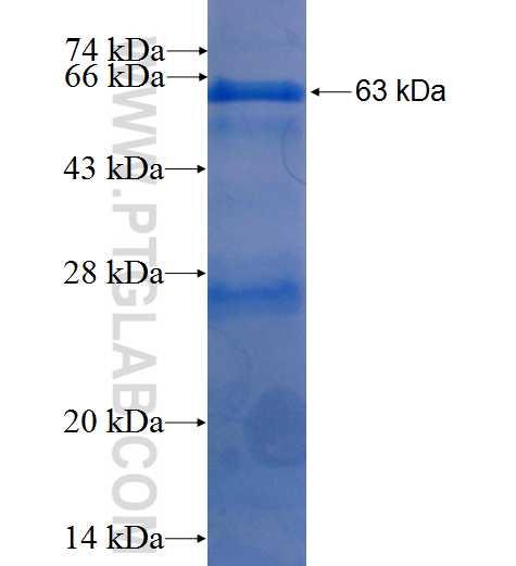 MMP19 fusion protein Ag5501 SDS-PAGE