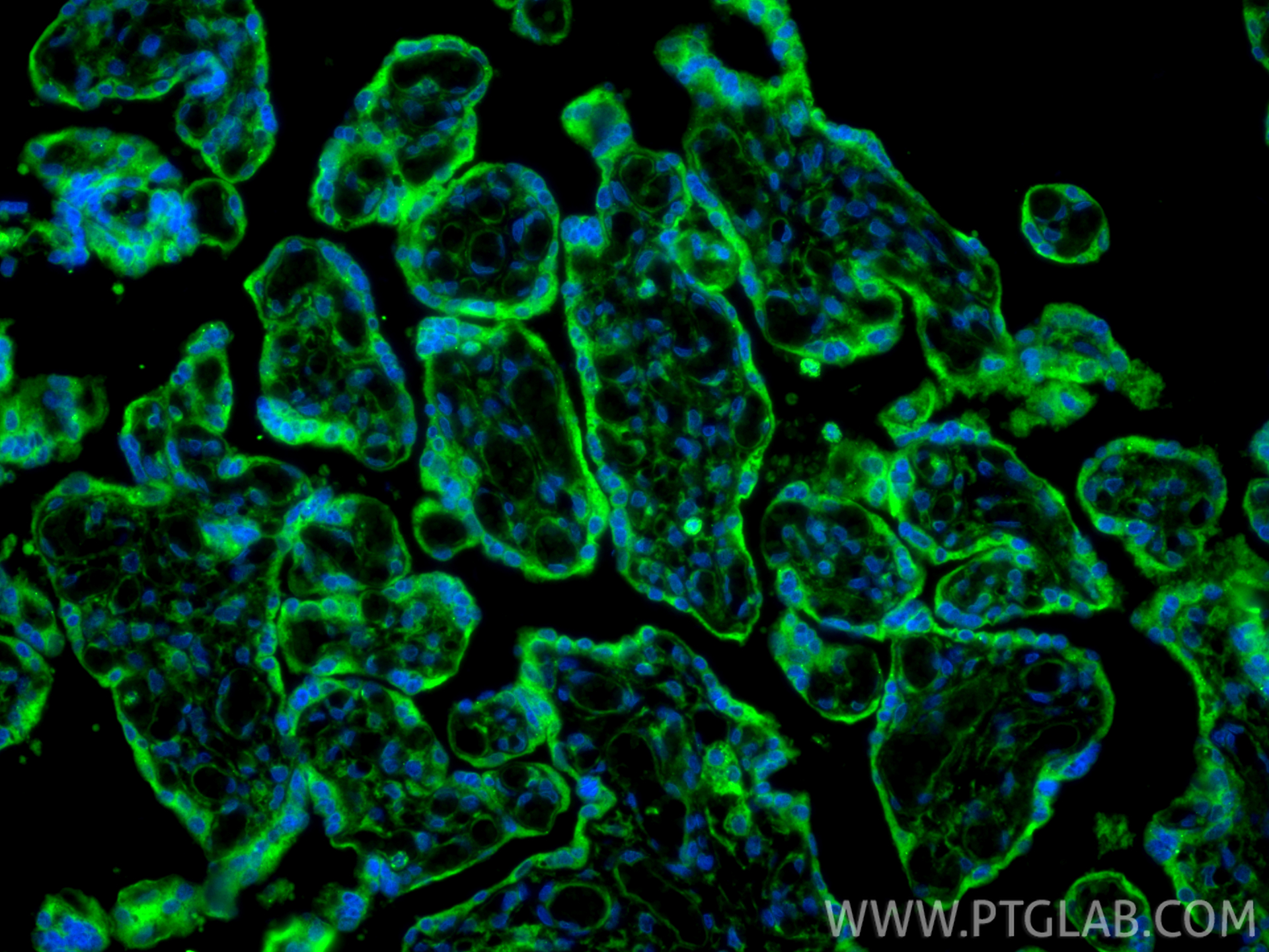 Immunofluorescent analysis of (4% PFA) fixed paraffin-embedded human placenta tissue using MMP2 antibody (10373-2-AP) at dilution of 1:200 and CoraLite®488-Conjugated Goat Anti-Rabbit IgG(H+L) (<a class='green' href='/productredirect?CatalogNo=SA00013-2' target='_blank'>SA00013-2</a>). Heat mediated antigen retrieval with Tris-EDTA buffer (pH 9.0). IF Staining of human placenta using 10373-2-AP