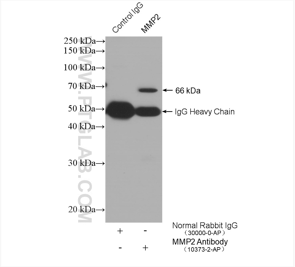 IP experiment of MCF-7 using 10373-2-AP