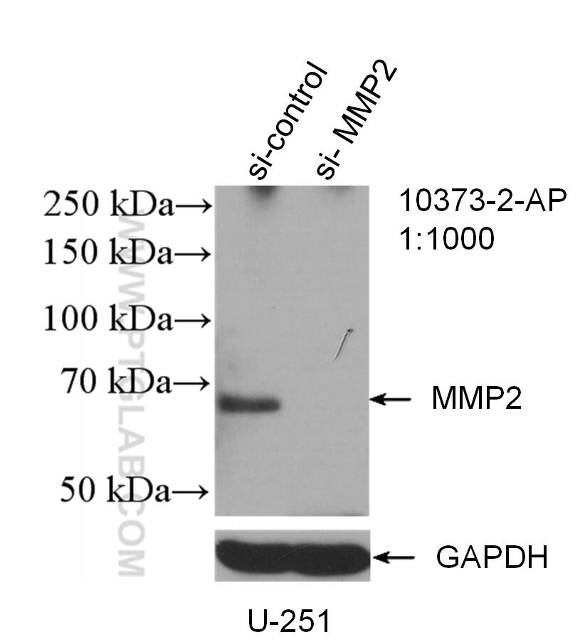 WB analysis of U-251 using 10373-2-AP